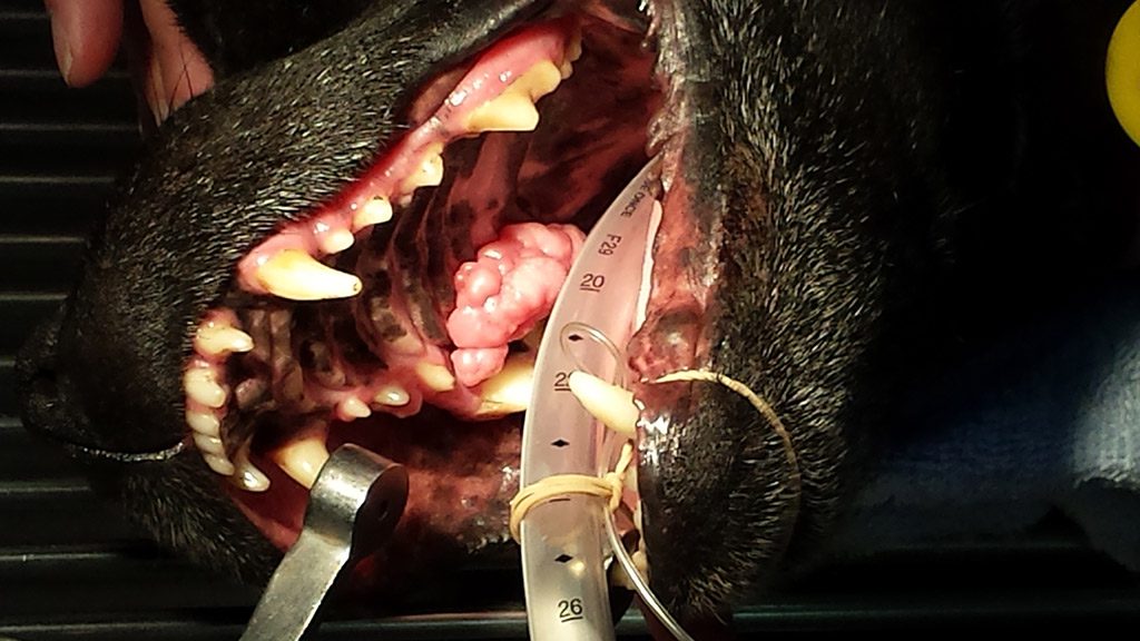 Oral Tumour 2