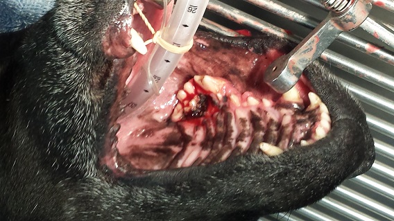 Oral Tumour